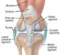 Knee Sprain Injury - Modern Treatment - Coolinventor Wiki